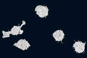 Характеристика, розробка, розташування та роль макрофагів Характеристика, розробка, розташування та роль макрофагів